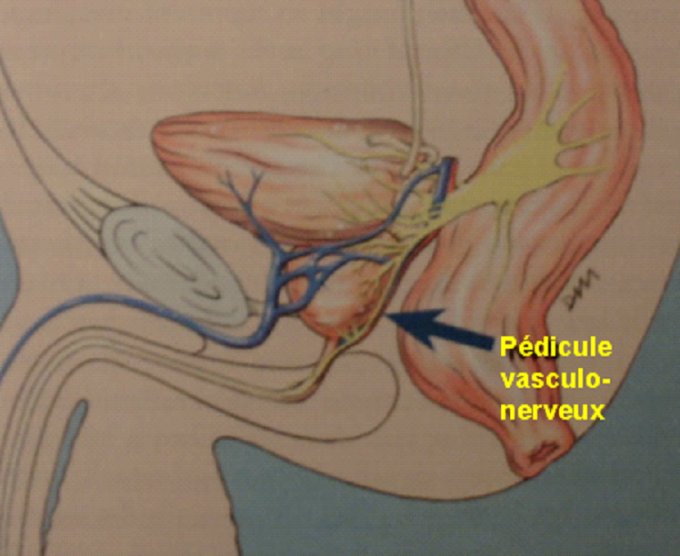 Pédicules vasculo-nerveux de la prostate
